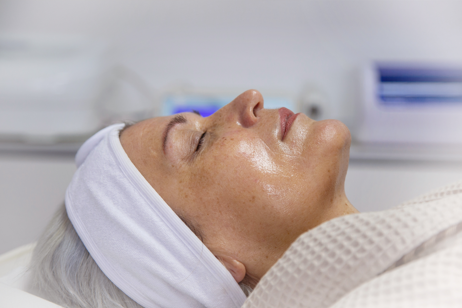 Wrinkle Reduction IPL treatments at Botanix Clinic