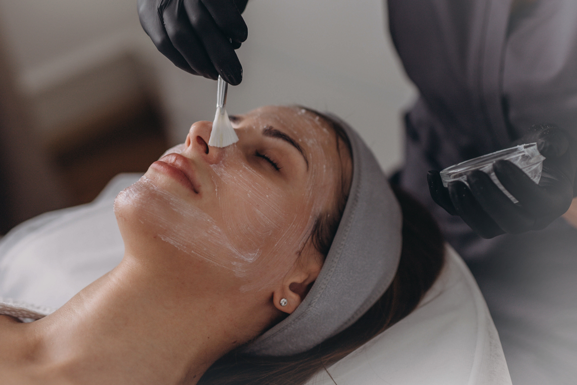 Chemical Peels